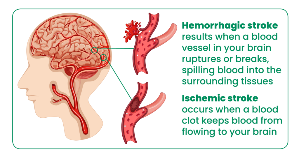 Stroke Awareness and Prevention